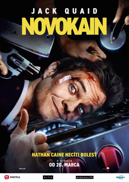 Novokain